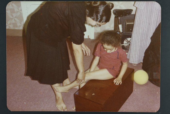A Girl Undergoing Physiotherapy, Cairo, 1980- 1985