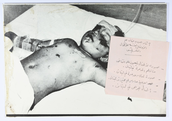 An Injured Boy Child, Lebanon, 1987