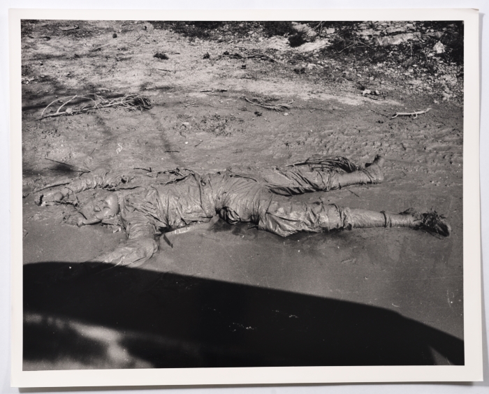 A Victim of Bombardment in the War of the Camps, Beirut, 1985- 1988