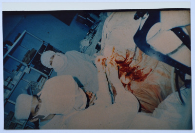 إجراء عملية جراحية، مخيم برج البراجنة، 1986