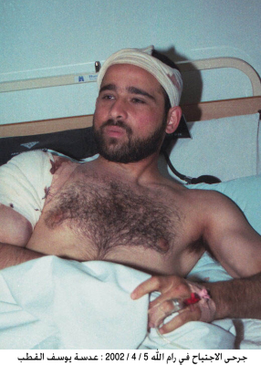 جرحى الانتفاضة الفلسطينية الثانية في رام الله