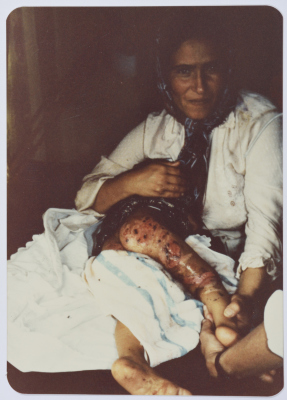 A Mother and Her Wounded Child, Shatila Camp, 1985