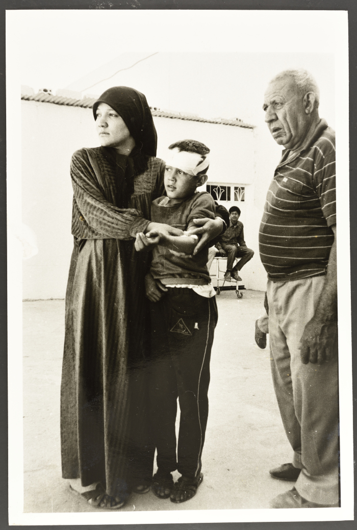 طفل فلسطيني مصاب، مخيم عين الحلوة، 1982- 1988