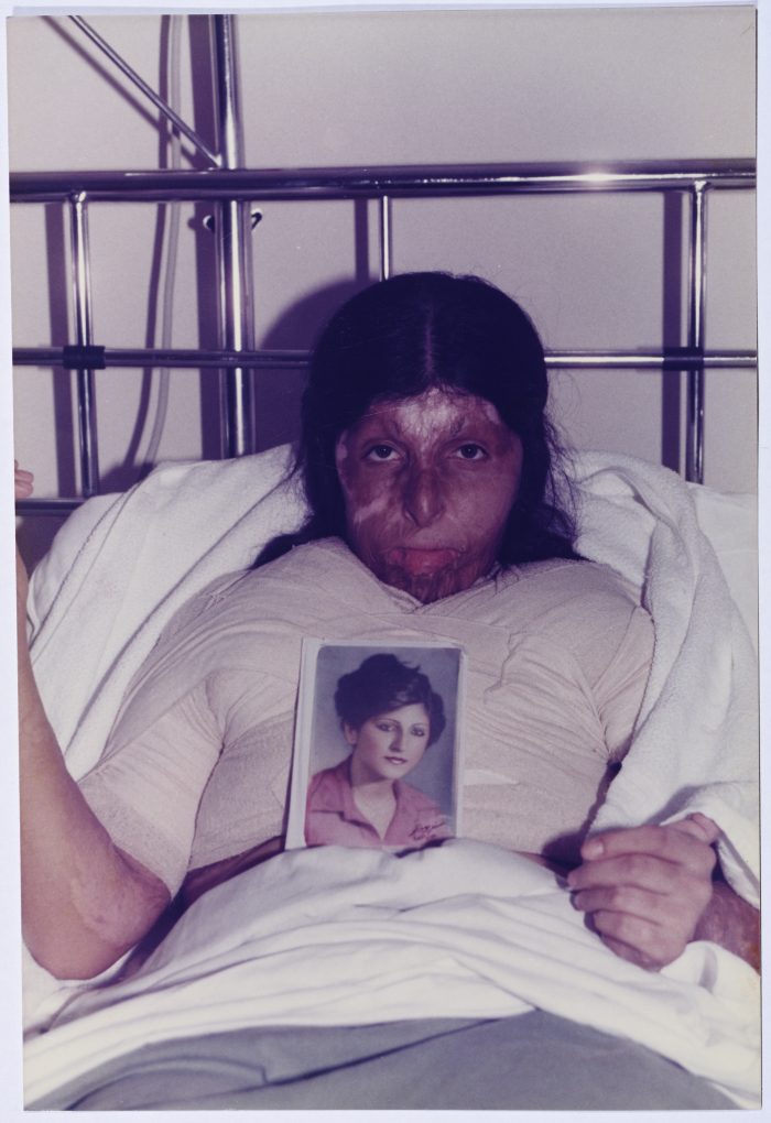 One of the wounded in the Israeli war over Lebanon 